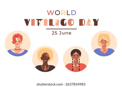 World vitiligo day. Diverse women with vitiligo. Happy smiling People with visible vitiligo patches smiling. Celebrating diversity and health education. Equality and skin positivity. Vector