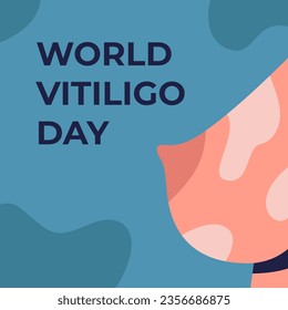 World Vitiligo Day. Female breasts with pigment spots on a background of dough and a blue background with spots. Flat vector illustration.