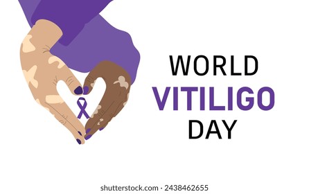 Día Mundial del Vitiligo. Manos haciendo forma de corazón sosteniendo la cinta de conciencia