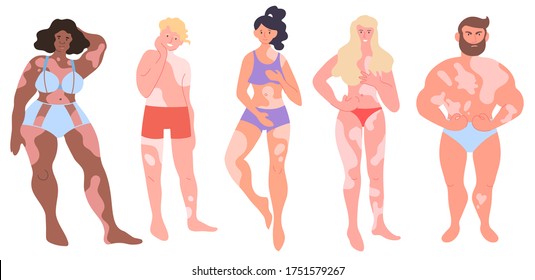 Día Mundial del Vitiligo - colección de vectores aislados. Mujeres y hombres con manchas pigmentarias - Retratos de cuerpo completo. Poner a jóvenes de diferentes razas con enfermedad de vitiligo. Diversidad de adultos jóvenes en ropa interior