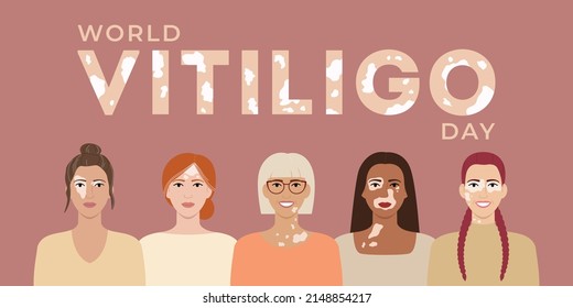 World vitiligo day June 25 banner. Female faces with different ethnics, skin colors, hairstyles with vitiligo skin disease. Body positive concept. Flat vector isolated illustration