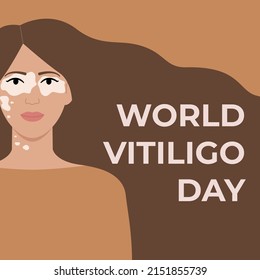 World Vitiligo Day June 25 Square Banner. Face Of Tan Woman With Vitiligo Skin Disease. Body Positive Concept. Flat Vector Illustration