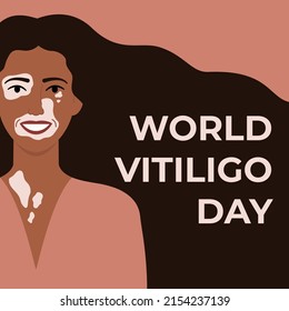 World Vitiligo Day June 25 Square Banner. Face Of African Woman With Vitiligo Skin Disease. Body Positive Concept. Flat Vector Illustration