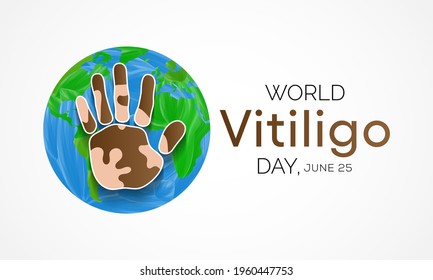 World Vitiligo day is observed every year on June 25, it is a long-term condition where pale white patches develop on the skin. It's caused by the lack of melanin, which is the pigment in skin