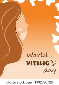 World Vitiligo Day poster. Beautiful woman with vitiligo. The vector is made in a flat style. Modern portrait in vector.