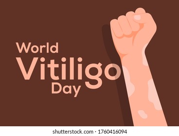 world vitiligo day poster,hand with vitiligo