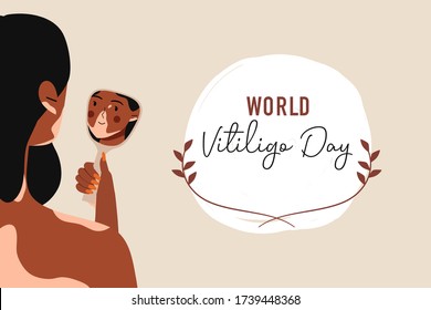 World vitiligo day. Smiling girls with skin problems Vitiligo staring at her reflection in a mirror. Accepting oneself. Self love. Skin disease. Body positive, depifmentation disease