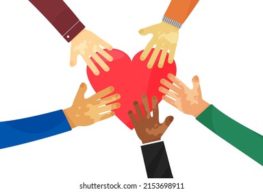 World Vitiligo Day vector banner, hands with pigmentation skin, different people. Healthcare illustration