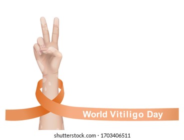 World vitiligo day. Vector illustration for templates and web banners