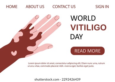Plantilla web del Día Mundial del Vitiligo. Mano con piel de despigmentación aislada en blanco. Carácter afroamericano con enfermedad de la piel. Ilustración vectorial de dibujos animados planos