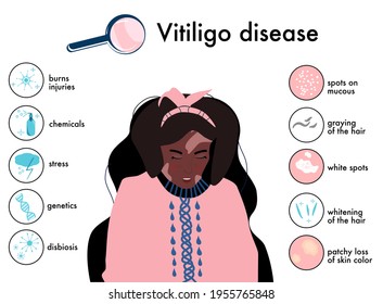 World vitiligo day.Infographics icons with symptoms and reasons of  sickness.Skin disease.Afro american woman with white spots.Pigmentation problem.Patchy loss of derma color.Vector banner