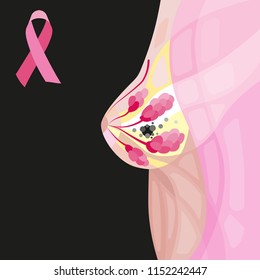 world woman breast cancer day diagram illustration