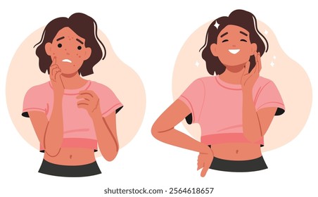 Worried and happy teenage girl cartoon character with unhealthy and healthy face skin area. Skincare procedure for treatment of red acne, pimples and inflammation problem vector illustration