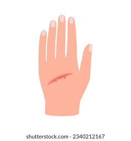 Wound of hand human skin, scratch. Cut injury skin, bleeding cut. Vector illustration