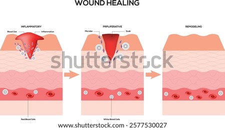 Wound Healing Science Design Vector Illustration Diagram