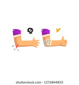 Wounded elbow with blood oozing, physical injury, first aid and treatment vector Illustration on a white background