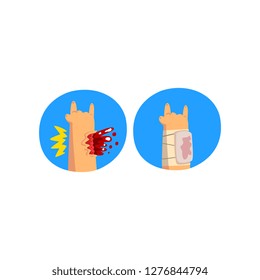 Wounded hand with blood oozing, first aid and treatment vector Illustration on a white background