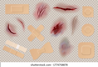 Yeso con heridas. Parche médico para costura quirúrgica, cicatriz, laceración, abrasión y daño de la piel, cinta plástica de primeros auxilios y atención médica, vector realista aislado sobre fondo transparente