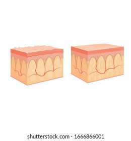 wrinkle and normal skin cross-section of human skin layers structure skincare medical concept flat vector illustration