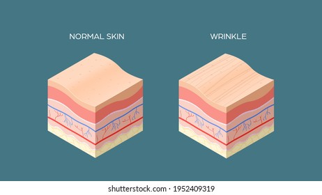 wrinkle and normal skin cross-section of human skin layers structure skincare medical concept flat horizontal