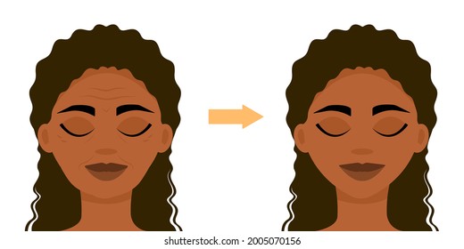 Wrinkles, age signs on african woman's face. The result of the procedure. Cosmetology, massage. Before and after the procedure.