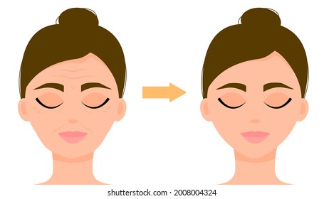 Wrinkles, age signs on a woman's face. The result of the procedure. Cosmetology, massage. Before and after the procedure. Vector illustration.