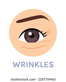 Wrinkles Around the Eye. Skin Problem. Tired Eye. Close up of Eye. Color Cartoon Style. White background. Vector illustration for Beauty and Cosmetic Design.