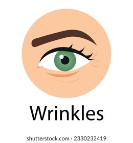 Wrinkles Around the Eye. Skin Problem. Tired Eye. Close up of Eye. Color Cartoon Style. White background. Vector illustration for Beauty and Cosmetic Design