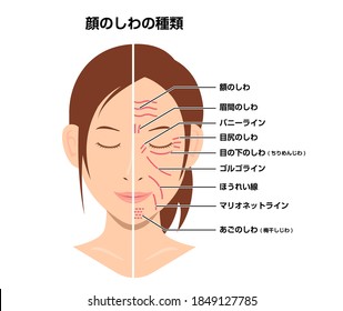 Wrinkles face and wrinkle-free face ( female face ) vector illustration / translation: forehead lines, crow's feet, bunny lines, marionette lines, neck wrinkles, frown lines, tear troughs, nasolabial 