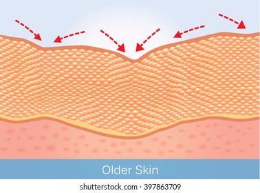 Wrinkles and sagging skin of elderly. This illustration about beauty and health care.