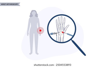 Wrist arthroscopy surgery. Minimal invasive procedure. Pain, injury and inflammation in the human arm. Arthroscope and arthroscopic instrument. Treatment of hand bones flat vector medical illustration