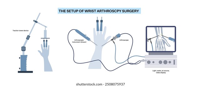 Wrist arthroscopy surgery. Minimal invasive procedure. Pain, injury and inflammation in the human arm. Arthroscope, traction tower device and arthroscopic instrument. Treatment of hand bones vector