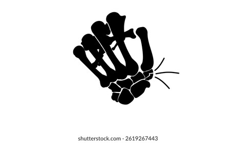 Wrist fracture, black isolated silhouette