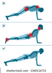 Wrong and correct plank pose. Right and wrong execution technique of sport exercise. Common mistakes in sport workout. Man standing on hands before push ups.