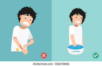 Wrong And Right Ways First Aid Emergency Treatment Skin Burn,illustration,vector