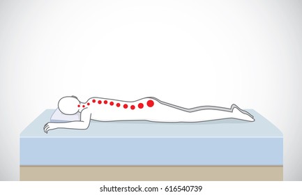 Wrong sleeping position make incorrect spinal alignment. Illustration about relax for good health.