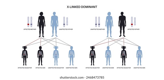 X linked dominant inheritance pattern. Child inherits one copy of a mutated gene from each parent. Genetic disease or disorder. Affected, carriers or healthy X and Y chromosomes vector illustration.