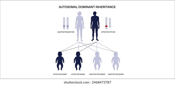 X linked dominant inheritance pattern. Child inherits one copy of a mutated gene from each parent. Genetic disease or disorder. Affected, carriers or healthy X and Y chromosomes vector illustration.