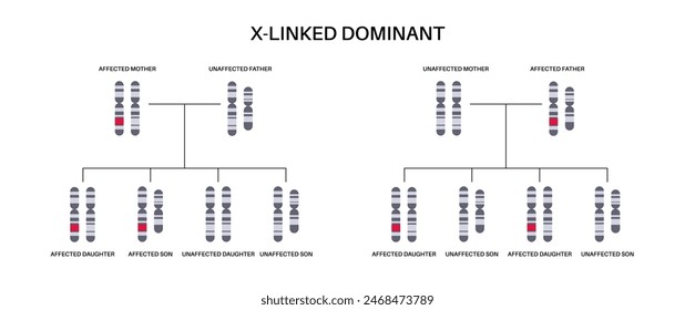 X linked dominant inheritance pattern. Child inherits one copy of a mutated gene from each parent. Genetic disease or disorder. Affected, carriers or healthy X and Y chromosomes vector illustration.