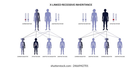 X Verknüpftes rezessives Vererbungsmuster. Kind erbt eine Kopie eines mutierten Gens von jedem Elternteil. Genetische Erkrankung oder Störung. Betroffene, Träger oder gesunde X- und Y-Chromosomen-Vektorillustration.