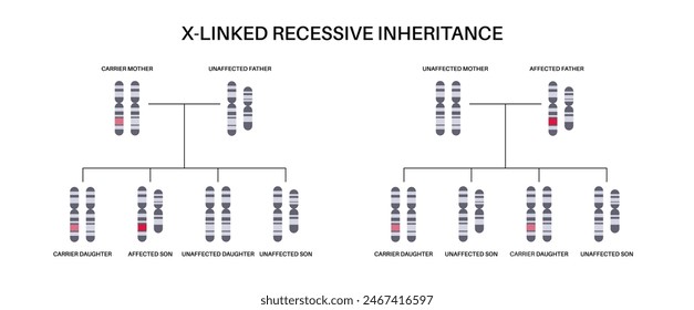 X linked recessive inheritance pattern. Child inherits one copy of a mutated gene from each parent. Genetic disease or disorder. Affected, carriers or healthy X and Y chromosomes vector illustration.