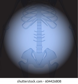 X ray backbone. Human skeleton's part on black background.