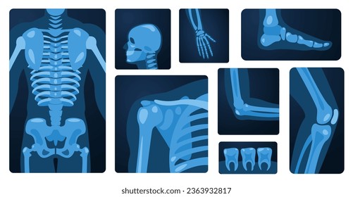 X ray body parts. Human skeleton knee arm chest wrist foot, medical x-ray imaging concept of bone injury. Vector flat set. Hospital checkup, scanning patient skull, teeth and shoulders