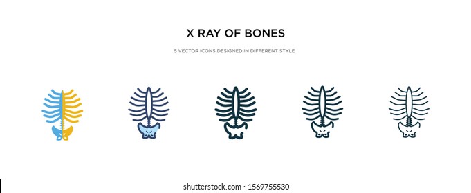 x ray of bones icon in different style vector illustration. two colored and black x ray of bones vector icons designed in filled, outline, line and stroke style can be used for web, mobile, ui