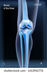 X ray of bones the of knee