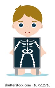 x ray check bones kid