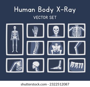 X Ray clipart cartoon style  Human body bones x ray flat vector set illustration hand drawn style  X Ray image different body parts  Skeleton  hand  skull  spine  rib  pelvis  foot  teeth x ray set