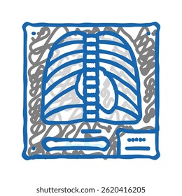 x ray fratura lesão ícone doodle esboço vetor. x ray fratura lesão sinal. símbolo isolado ilustração