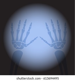 X ray hands. Human skeleton's part on black background.