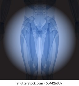 X ray hips. Human skeleton's part on black background.